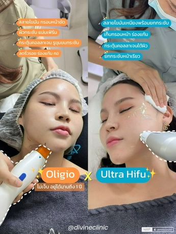 Divine Aesthetic Clinic Divine Aesthetic Clinic - ดีไวน์ คลินิก ปรับรูปหน้าและฟิลเลอร์ ย่านห้วยขวาง image_picker_13938674-58F1-4EE7-938F-9A0487BE0F5D-16913-0000308EFA02C11F