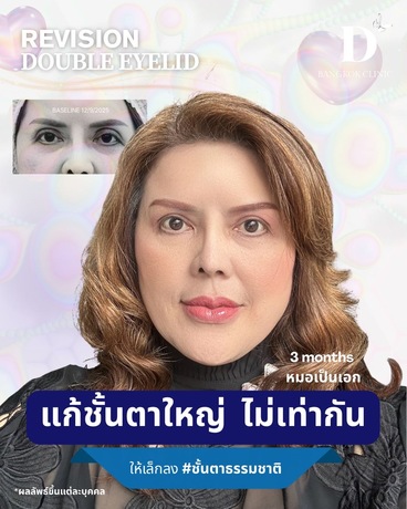 D Bangkok Clinic D Bangkok Clinic - ดีแบ็งค็อกคลินิก ความงามครบวงจร ย่านทองหล่อ image_picker_7BD1AEC8-DE36-4E76-9F4F-6CD47FA44B20-72338-00001657D2B97776