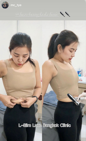 Luxe Bangkok Clinic (BTS Phahonyothin 24) Luxe Bangkok Clinic (BTS Phahonyothin 24) (มีสาขาเดียวเท่านั้น)  image_picker_A605C4B4-39F6-47D6-A131-10DCFC336C17-92103-00000A74E4B8EF9E