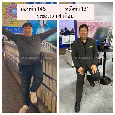 Luxe Bangkok Clinic (BTS Phahonyothin 24) Luxe Bangkok Clinic (BTS Phahonyothin 24) (มีสาขาเดียวเท่านั้น)  image_picker_090080CC-2B14-4740-B197-E059F453BF3A-92103-00000A74E61BB29F