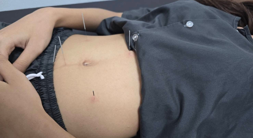 FUXINZAI CLINIC FUXINZAI CLINIC - ฟู่ ซิน ไฉ คลินิก ธัญบุรี ปทุมธานี ฝังเข็มแผนจีน 2