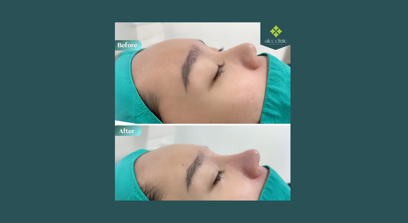Camena Clinic Camena Clinic - คามีนา คลินิก เสริมความงาม ลาดพร้าว 7
