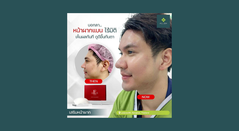 Camena Clinic Camena Clinic - คามีนา คลินิก เสริมความงาม ลาดพร้าว 8