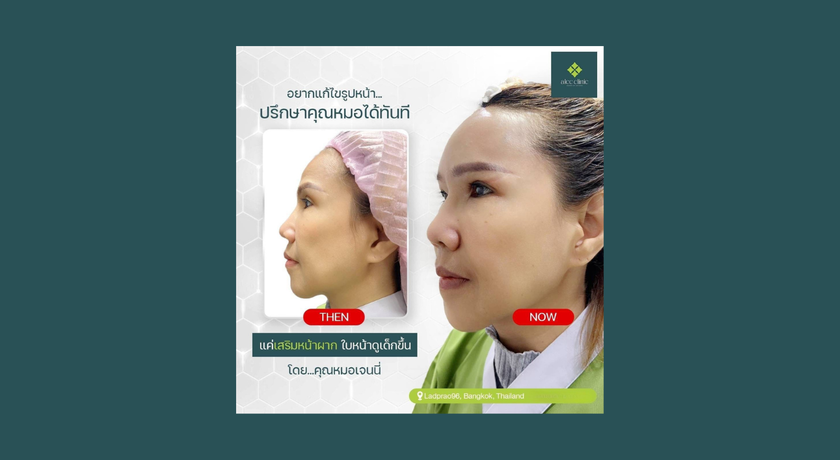 Camena Clinic Camena Clinic - คามีนา คลินิก เสริมความงาม ลาดพร้าว 9