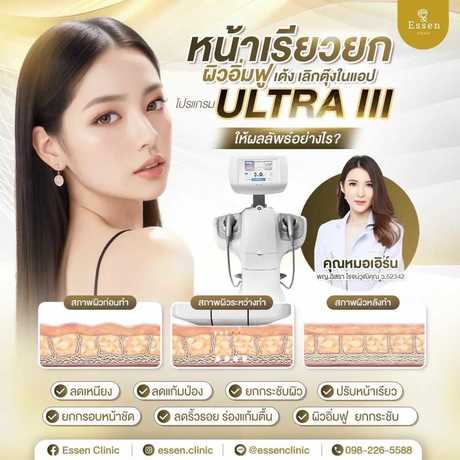 Essen Clinic Essen Clinic - เอสเซนคลินิก ปรับรูปหน้าเฉพาะบุคคล ย่านปากเกร็ด scaled_1000129234