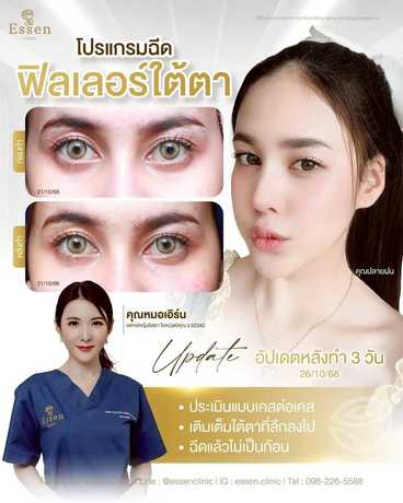 Essen Clinic Essen Clinic - เอสเซนคลินิก ปรับรูปหน้าเฉพาะบุคคล ย่านปากเกร็ด scaled_1000129218