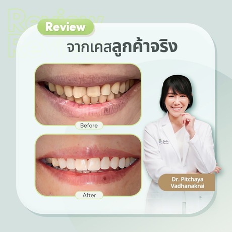 Belix Dental Clinic  image_picker_9E533638-C553-49FF-B7EA-4E5A806326F4-10193-00000377138644DD