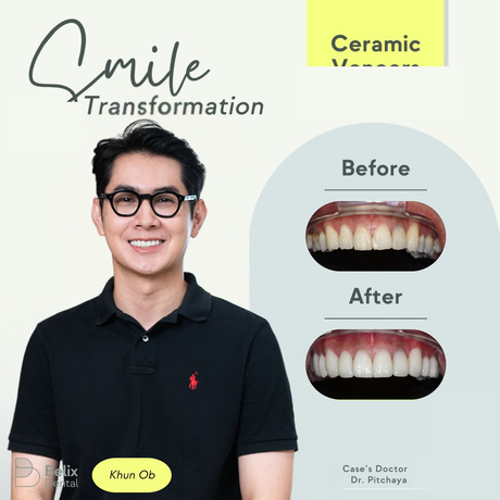 Belix Dental Clinic  image_picker_5104A727-63E5-4CD7-B1EF-4833EA6784B9-10193-00000377130C6541