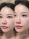 image_picker_1E43B72A-E1F1-44BD-A833-BD6A88AC4C85-33267-000003FF77F7FEB2