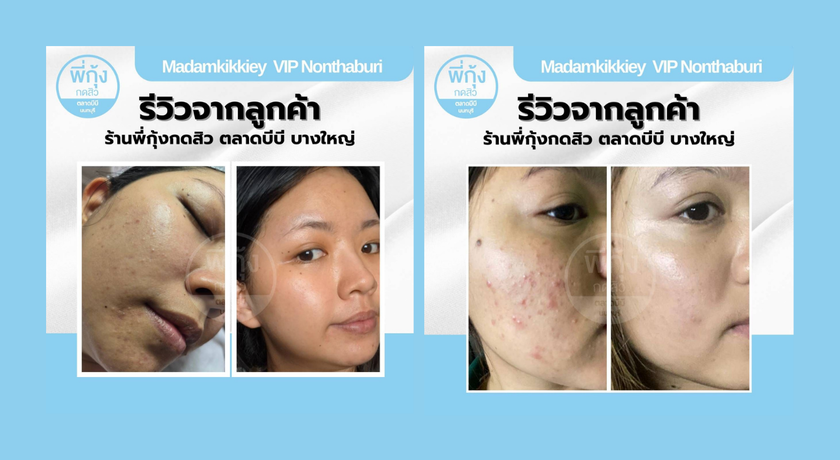 Madamkikikiey (BB Market Park) Madamkikikiey (BB Market Park) – พี่กุ้งกดสิว ตลาดบีบี บางใหญ่ 12