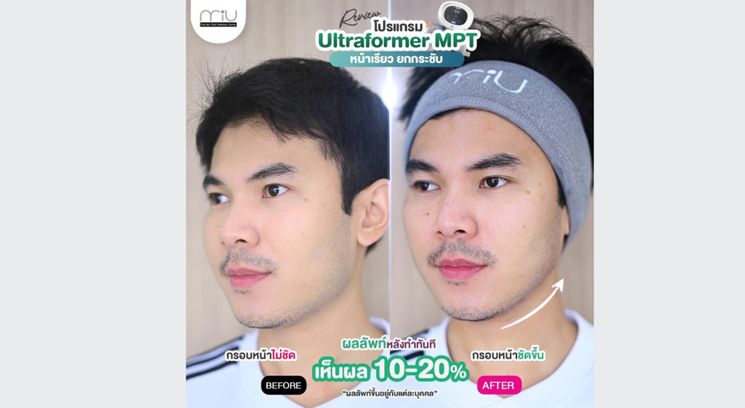 The MiU Wellbeing Clinic (Bangna Branch) The MiU Wellbeing Clinic (Bangna Branch) – ดิ มิว เวลบีอิ้ง คลินิก ความงาม บางนา 10