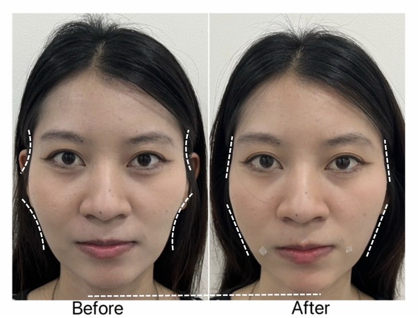 Luxe Bangkok Clinic (BTS Phahonyothin 24) Luxe Bangkok Clinic (BTS Phahonyothin 24) (มีสาขาเดียวเท่านั้น)  image_picker_CD31CD4F-2F58-41F8-A657-0A53BE2F6A34-47020-00000522FF8115D0