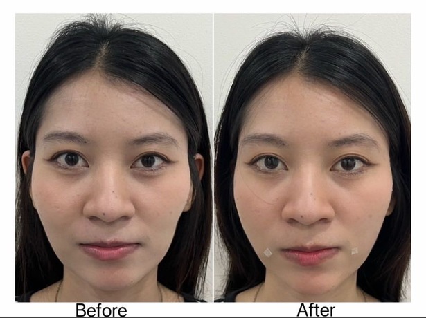 Luxe Bangkok Clinic (BTS Phahonyothin 24) Luxe Bangkok Clinic (BTS Phahonyothin 24) (มีสาขาเดียวเท่านั้น)  image_picker_71A80721-ED4F-4350-8ABE-212A42A888DB-47020-00000522FD90B78F