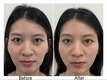 image_picker_71A80721-ED4F-4350-8ABE-212A42A888DB-47020-00000522FD90B78F