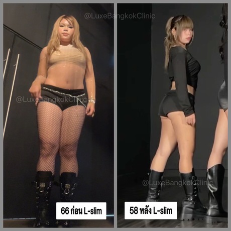 Luxe Bangkok Clinic (BTS Phahonyothin 24) Luxe Bangkok Clinic (BTS Phahonyothin 24) (มีสาขาเดียวเท่านั้น)  image_picker_C91F6C9A-5D23-42E6-B416-37D437E0B9DC-48638-00000545F0E774B2