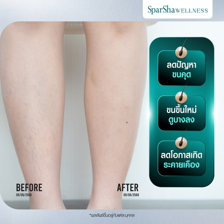 SparSha SparSha - สปาชา สวยครบ จบที่เดียว สุขุมวิท 39 615425524_1334408572058863_4793451890887515533_n