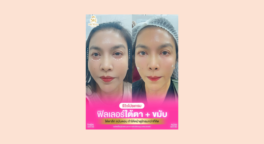 Sirimaya Clinic Sirimaya Clinic – สิริมายา คลินิก เสริมความงาม บางซ่อน เดินทางสะดวก 10