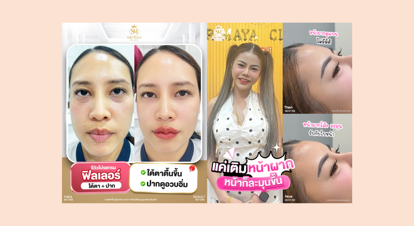 Sirimaya Clinic Sirimaya Clinic – สิริมายา คลินิก เสริมความงาม บางซ่อน เดินทางสะดวก 9