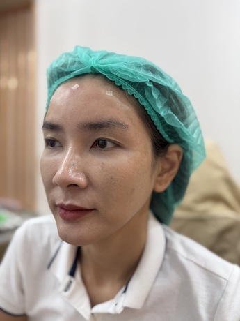 Eluceat Wellness Clinic Eluceat Wellness Clinic – เอลูเชต เวลเนส คลินิก ย่านลาดพร้าว image_picker_5E9CE935-83B5-4157-A9F0-B3D3A1583418-16313-000005E28DB633CC