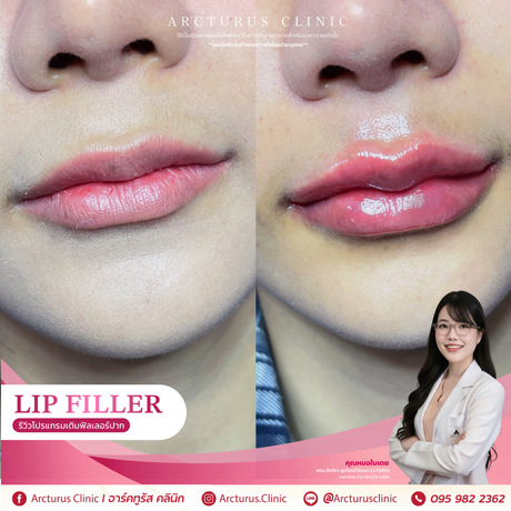 Arcturus Clinic Arcturus Clinic - อาร์คทูรัส คลินิก บริการความงามครบวงจร ย่านพัฒนาการ image_picker_9AE9E128-5868-4D2D-803B-30DFD2FA0E5B-34512-00000AB530997416