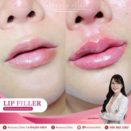 Arcturus Clinic Arcturus Clinic - อาร์คทูรัส คลินิก บริการความงามครบวงจร ย่านพัฒนาการ image_picker_0FCC55FE-1103-4729-8B86-47C92234DA95-34512-00000AB5303B5E64