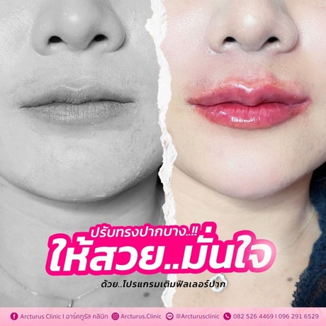 Arcturus Clinic Arcturus Clinic - อาร์คทูรัส คลินิก บริการความงามครบวงจร ย่านพัฒนาการ image_picker_3B298E69-9A00-479E-AB47-D55B3B1D8629-34512-00000AB5318190CA