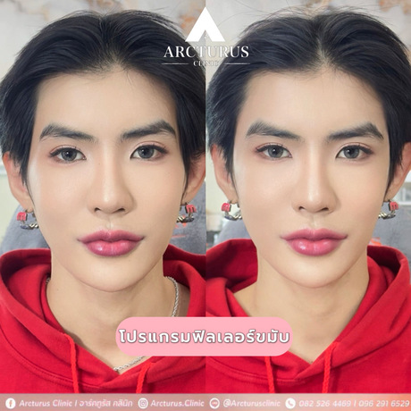 Arcturus Clinic Arcturus Clinic - อาร์คทูรัส คลินิก บริการความงามครบวงจร ย่านพัฒนาการ image_picker_B044AF58-BF07-4A81-8B46-FAE14A67A3AC-34512-00000AB6A8339BD1
