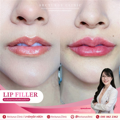 Arcturus Clinic Arcturus Clinic - อาร์คทูรัส คลินิก บริการความงามครบวงจร ย่านพัฒนาการ image_picker_8C444381-4DD7-4FD8-AAB2-7285B84C8812-34512-00000AB621B928D3