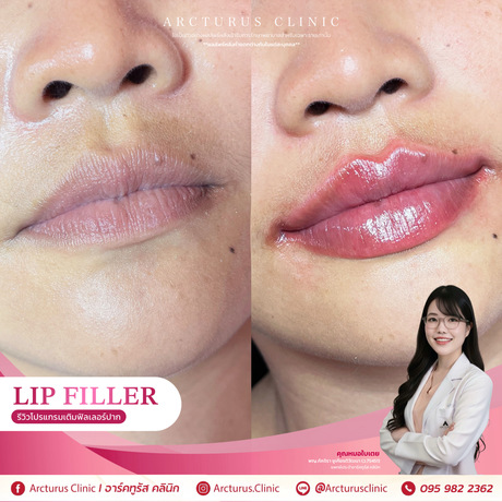 Arcturus Clinic Arcturus Clinic - อาร์คทูรัส คลินิก บริการความงามครบวงจร ย่านพัฒนาการ image_picker_82017372-A0F4-4D4E-BC5B-A49248B19911-34512-00000AB61F990F1E