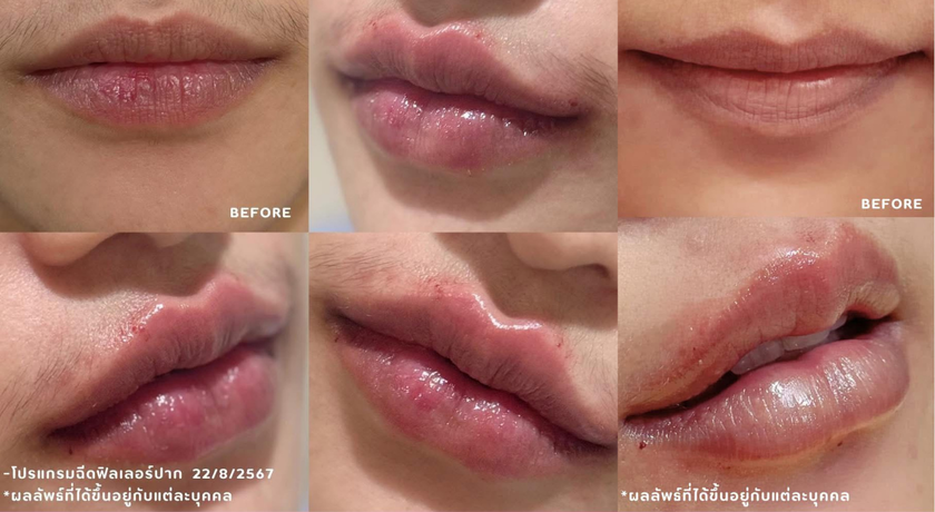Grand Luxury Clinic Grand Luxury Clinic – แกรนด์ ลักชัวรี คลินิก ความงามย่านรัชดา 4