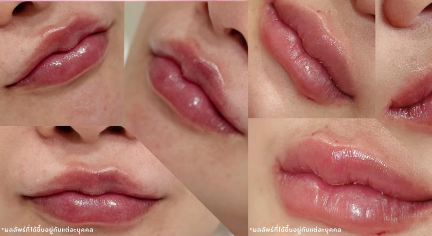 Grand Luxury Clinic Grand Luxury Clinic – แกรนด์ ลักชัวรี คลินิก ความงามย่านรัชดา 5