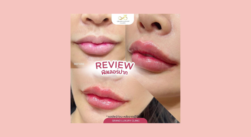 Grand Luxury Clinic Grand Luxury Clinic – แกรนด์ ลักชัวรี คลินิก ความงามย่านรัชดา 6