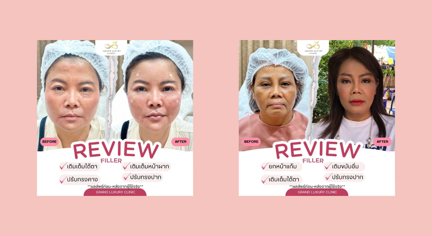 Grand Luxury Clinic Grand Luxury Clinic – แกรนด์ ลักชัวรี คลินิก ความงามย่านรัชดา 8