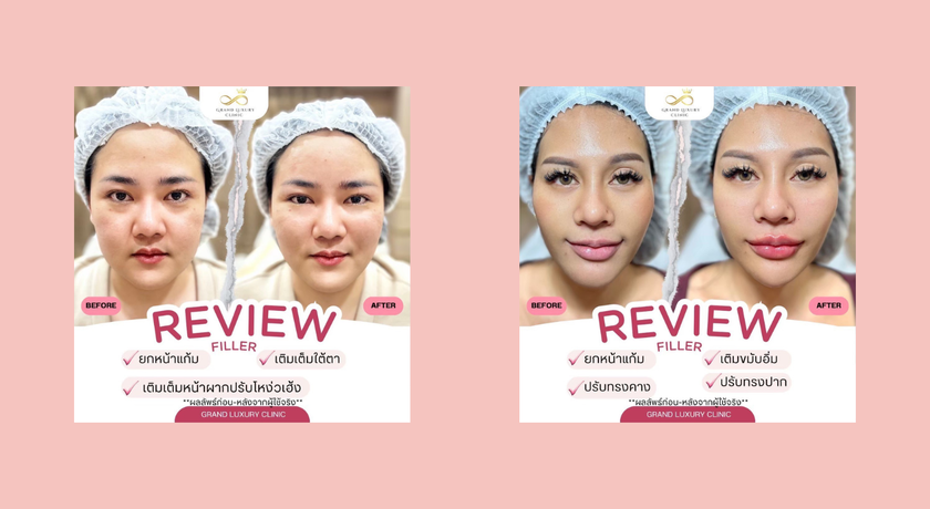 Grand Luxury Clinic Grand Luxury Clinic – แกรนด์ ลักชัวรี คลินิก ความงามย่านรัชดา 9