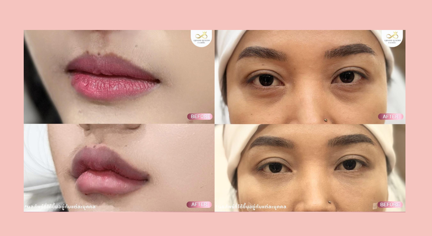 Grand Luxury Clinic Grand Luxury Clinic – แกรนด์ ลักชัวรี คลินิก ความงามย่านรัชดา 10