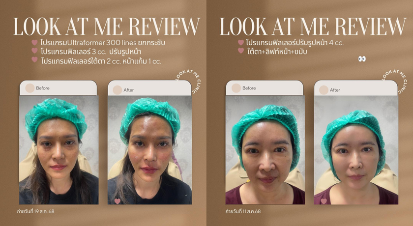 Look At Me Clinic Look At Me Clinic – ลุค แอท มี คลินิก เสริมความงามพระโขนง 7