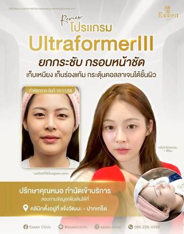 Essen Clinic Essen Clinic - เอสเซนคลินิก ปรับรูปหน้าเฉพาะบุคคล ย่านปากเกร็ด line_oa_chat_260210_105812