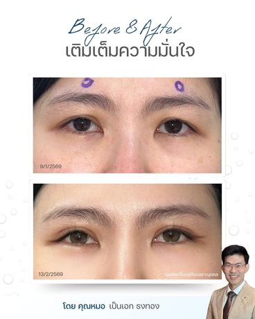 D Bangkok Clinic D Bangkok Clinic - ดีแบ็งค็อกคลินิก ความงามครบวงจร ย่านทองหล่อ image_picker_A7FEAD35-1F90-4B5F-9B5D-228D8880FA8C-18729-00000219B88B825D