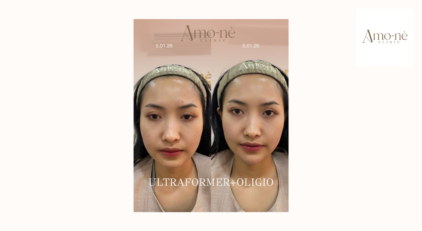 Amo-nè Clinic (Phetchaburi Soi 15, BTS Ratchathewi) (Amone Clinic) Amo-nè Clinic – อาโมเน่ คลินิก ความงามย่านเพชรบุรี 15 28