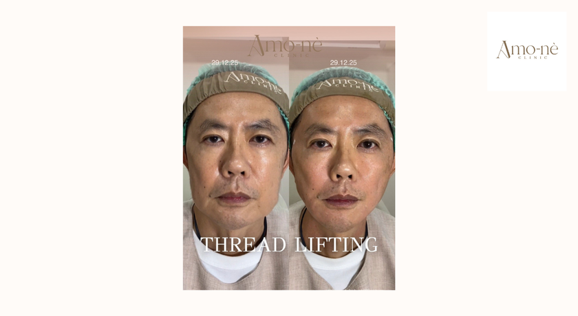 Amo-nè Clinic (Phetchaburi Soi 15, BTS Ratchathewi) (Amone Clinic) Amo-nè Clinic – อาโมเน่ คลินิก ความงามย่านเพชรบุรี 15 29