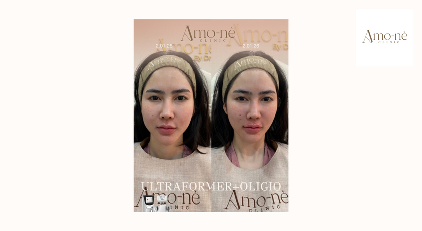 Amo-nè Clinic (Phetchaburi Soi 15, BTS Ratchathewi) (Amone Clinic) Amo-nè Clinic – อาโมเน่ คลินิก ความงามย่านเพชรบุรี 15 33