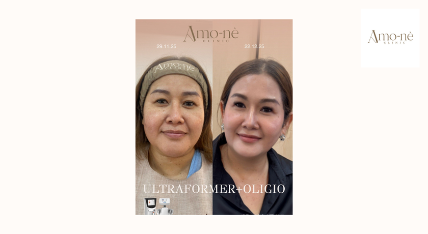 Amo-nè Clinic (Phetchaburi Soi 15, BTS Ratchathewi) (Amone Clinic) Amo-nè Clinic – อาโมเน่ คลินิก ความงามย่านเพชรบุรี 15 35