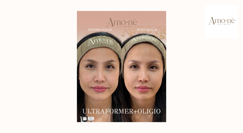 Amo-nè Clinic (Phetchaburi Soi 15, BTS Ratchathewi) (Amone Clinic) Amo-nè Clinic – อาโมเน่ คลินิก ความงามย่านเพชรบุรี 15 36