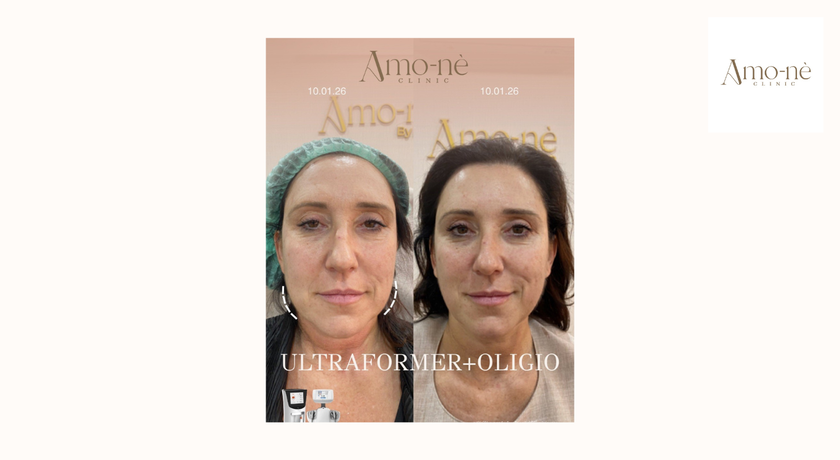 Amo-nè Clinic (Phetchaburi Soi 15, BTS Ratchathewi) (Amone Clinic) Amo-nè Clinic – อาโมเน่ คลินิก ความงามย่านเพชรบุรี 15 37