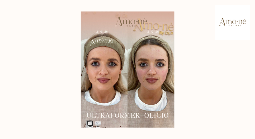 Amo-nè Clinic (Phetchaburi Soi 15, BTS Ratchathewi) (Amone Clinic) Amo-nè Clinic – อาโมเน่ คลินิก ความงามย่านเพชรบุรี 15 38
