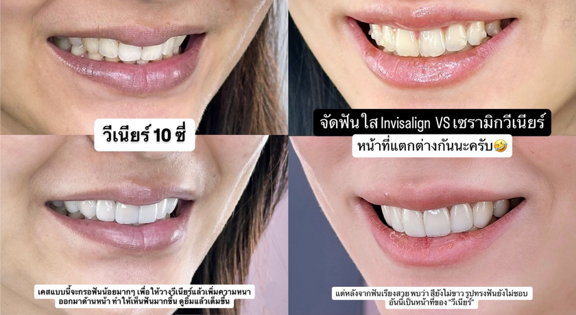 SM Dental (Pattanakarn) SM Dental - สไมล์เมโลดี้ พัฒนาการ ใกล้ซอย 44 7