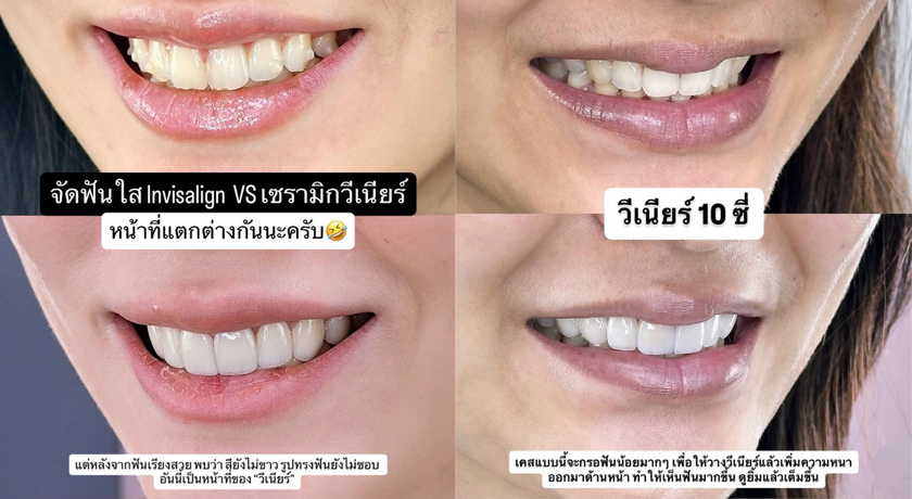 SM Dental (Rom Klao) SM Dental - สไมล์เมโลดี้ ร่มเกล้า ลาดกระบัง 3