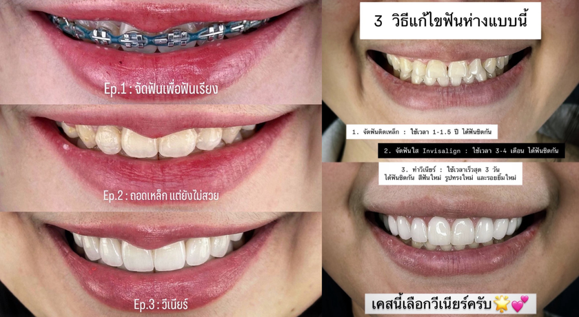 SM Dental (Rom Klao) SM Dental - สไมล์เมโลดี้ ร่มเกล้า ลาดกระบัง 4