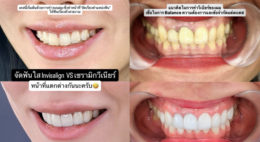 The Veneer By SM Dental (Siamsquare One) The Veneer By SM Dental - เดอะ วีเนียร์ บาย เอสเอ็ม เดนทัล สยามสแควร์วัน 5