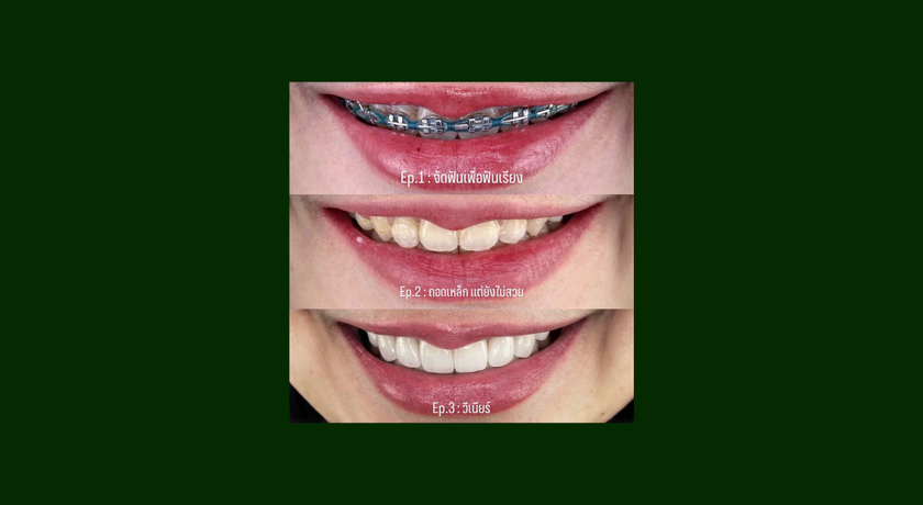 The Veneer By SM Dental (Siamsquare One) The Veneer By SM Dental - เดอะ วีเนียร์ บาย เอสเอ็ม เดนทัล สยามสแควร์วัน 7